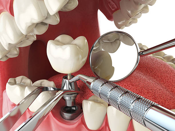 Best Orthodontic Emergency Dentist in Bloomfield, IN