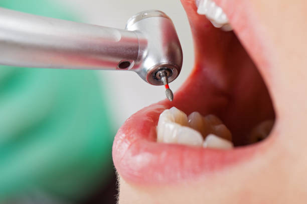 Best Weekend Emergency Dentist in Bloomfield, IN
